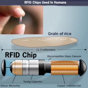 where does it mention the rfid chip in obama care|On Emerging Technology: What to Know When Your Patient Has .